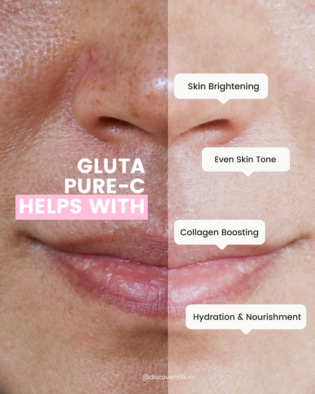 The Science Behind Gluta Pure-C: A Research-Based Approach to Brighter Skin