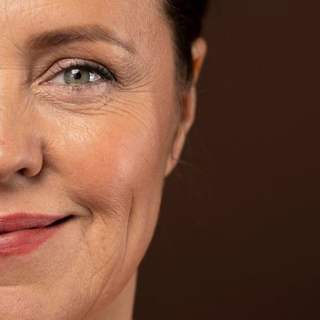 Antiaging & Finelines