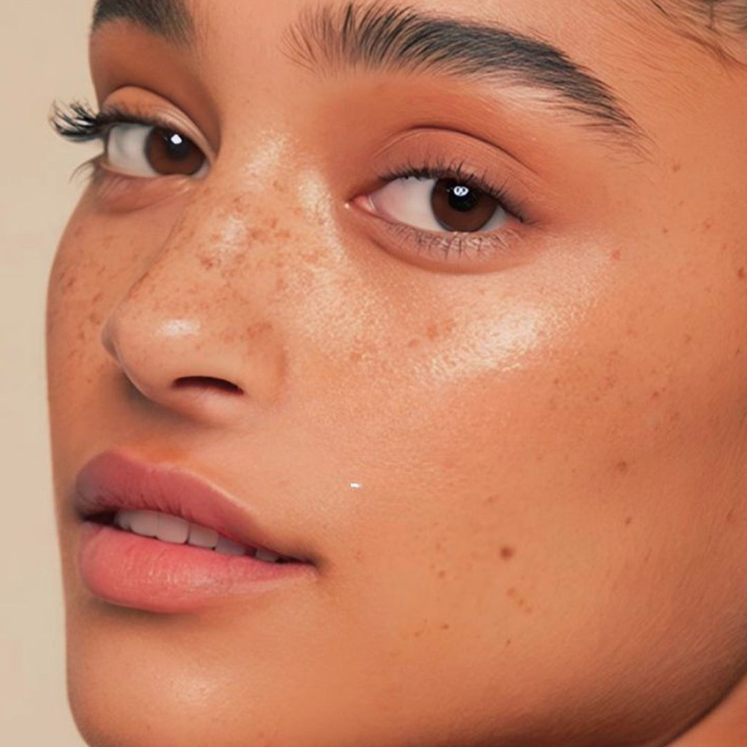 Hyperpigmentation + Dullness