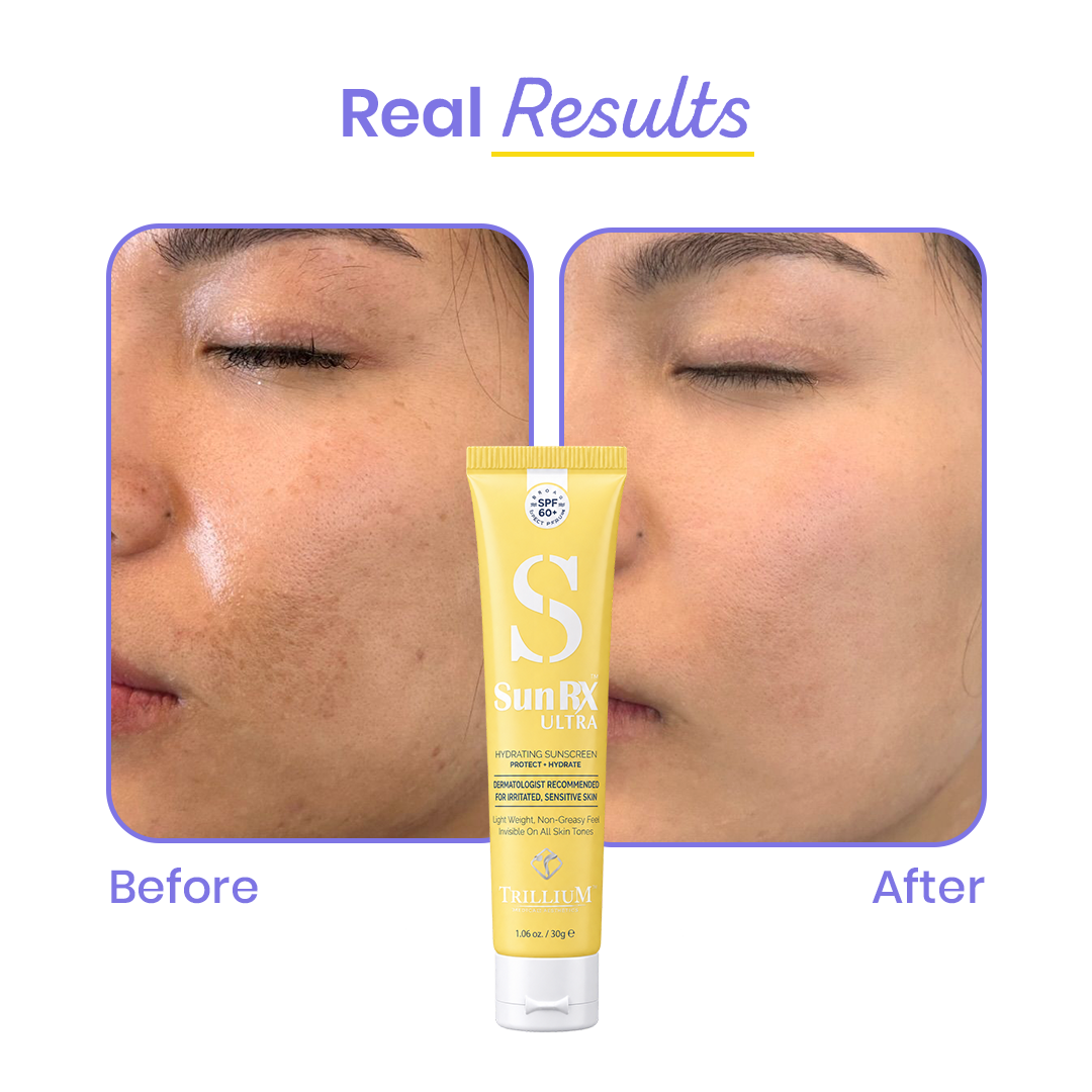 SunRX Ultra SPF60+ Sunscreen