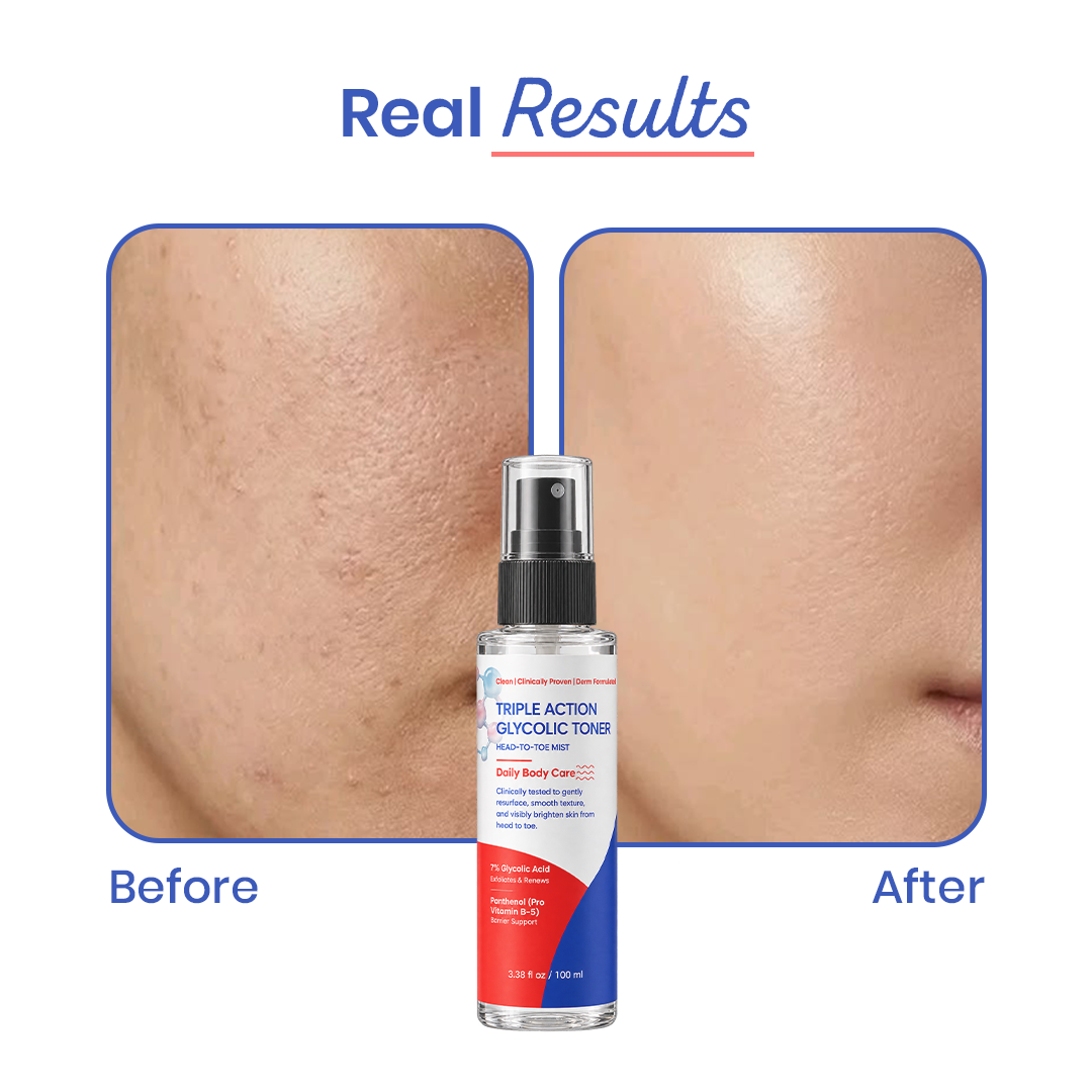 Triple Action Glycolic Toner