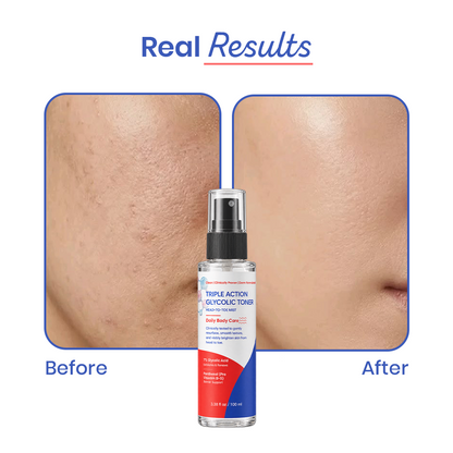 Triple Action Glycolic Toner