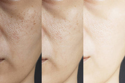 Gluta Pure-C Intensive Skin Brightening Serum